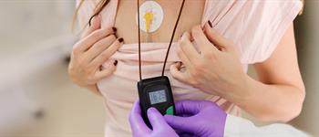 Holter de arritmia: ¿para qué sirve?