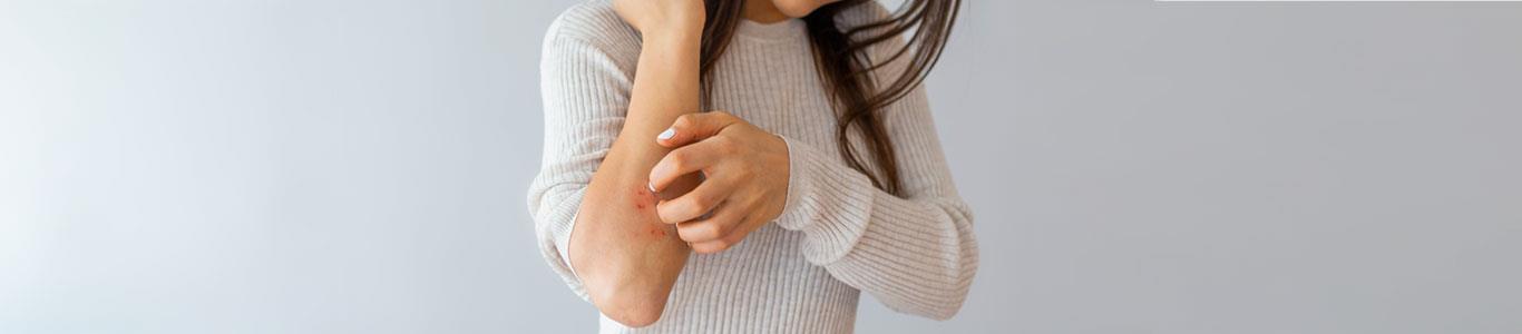 Avances en los tratamientos contra la psoriasis