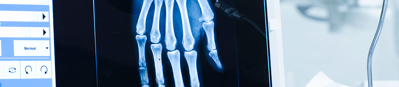clinicaalemana_salud_articulos_inteligencia_artificial_edad_osea Inteligencia Artificial para diagnosticar la edad ósea