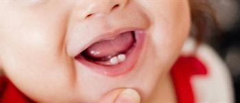 ¿Qué hacer cuando aparecen los primeros dientes de mi hijo?