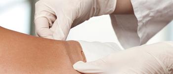 clinica-alemana-articulo-salud-heridas-cicatrizacion heridas-cicatrización-piel