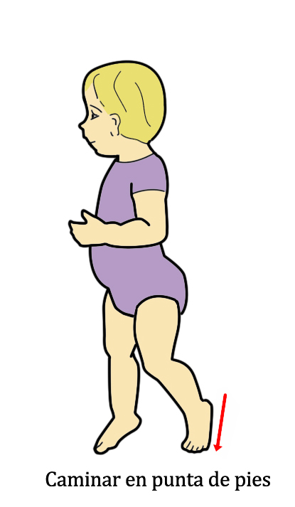 Diagrama de niño caminando en punta de pies