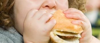 Ninos_Obesidad