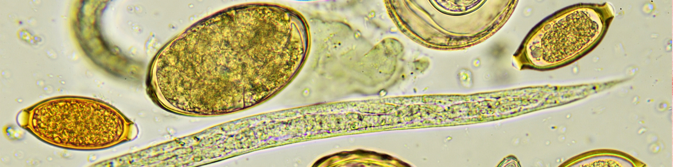 Enterobius vermicularis huevo Oxiuros en orina