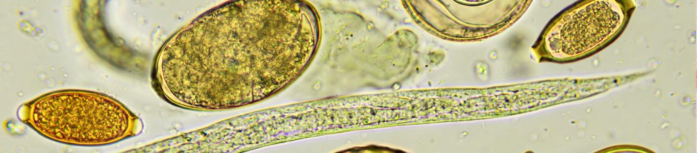 como eliminar huevos de oxiuros hpv cancer link