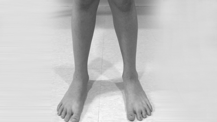 columna+infantil columna+infantil