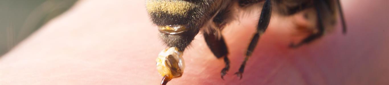 Cómo prevenir y actuar ante una picadura de abeja