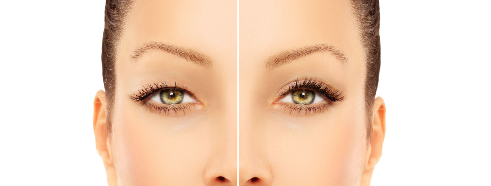 Blefaroplastía estética: para recuperar una mirada joven y descansada