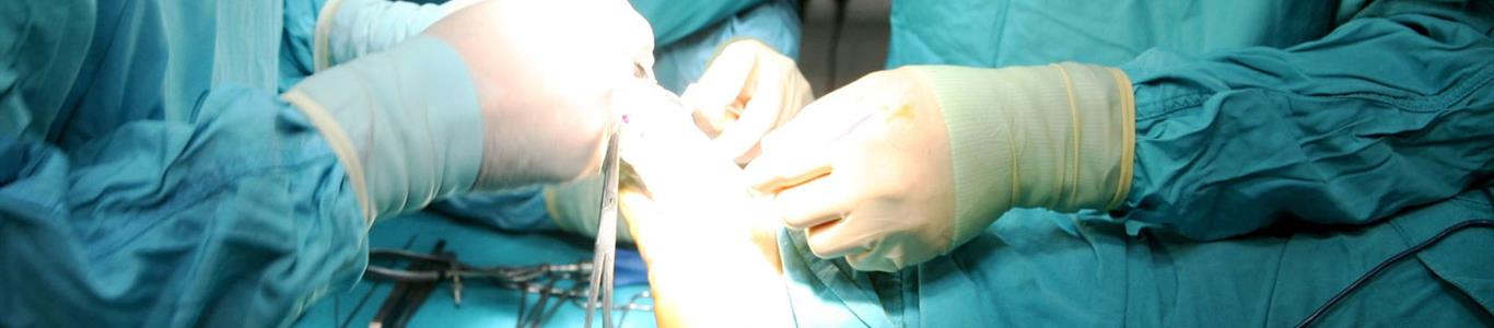 Nueva cirugía de juanete disminuye riesgo de recurrencia