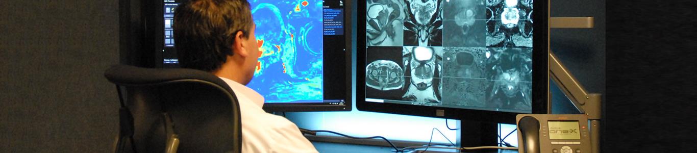 Resonancia magnética cobra relevancia en diagnóstico de cáncer de próstata