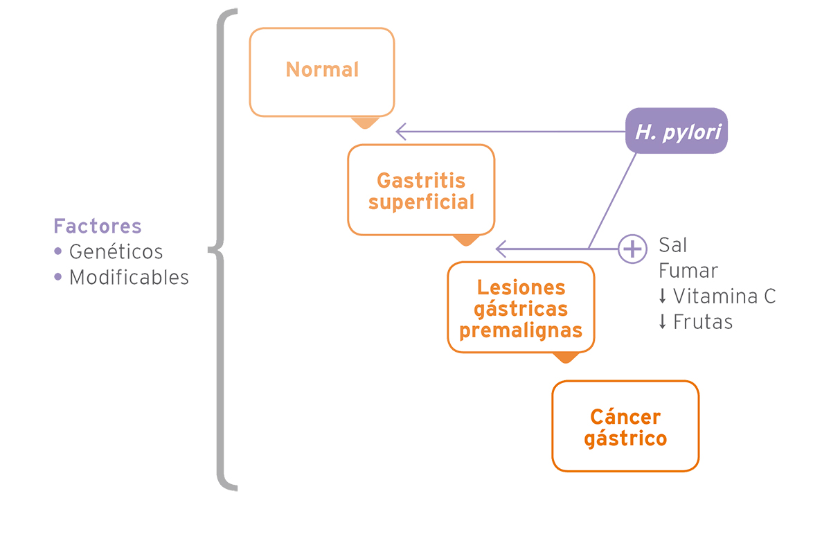 Carcinogénesis Gástrica