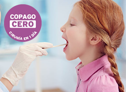 Copago_Fijo_Amigdalas