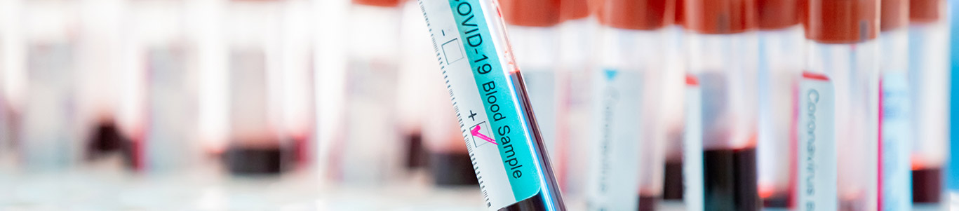 testimonio plasma covid-19 Donante de plasma: “El proceso no es molesto y no me siento mal”