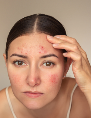 Dermatología OnDemand