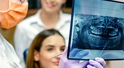 Clínica dental Everest Descuentos