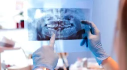 Clínica dental Everest Descuentos