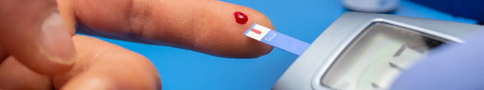 Medición de glucosa en sangre mediante examen preventivo, clave para detectar síntomas de prediabetes a tiempo.