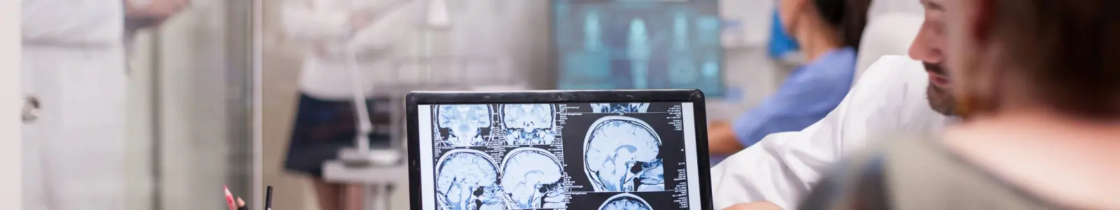 Especialista médico revisando tomografía cerebral tras un ACV, representando la cobertura del seguro de salud.
