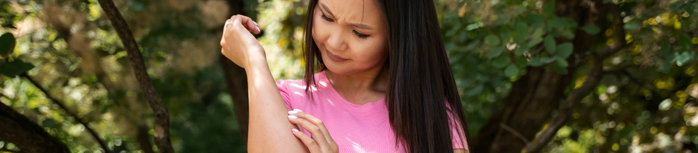 Mujer con alergia en la piel, rasguñándose el brazo debido a irritación por polen y alérgenos primaverales.