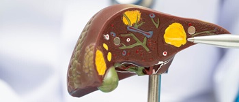 Modelo anatómico de hígado utilizado por un profesional de la salud para explicar cómo prevenir la hepatitis, en el contexto de una campaña informativa de Alemana Seguros.