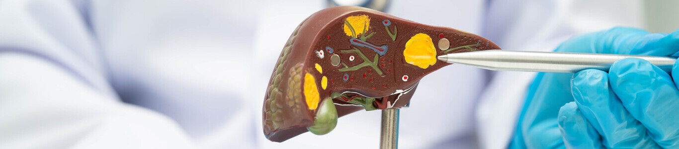 Cómo prevenir la hepatitis y proteger tu hígado