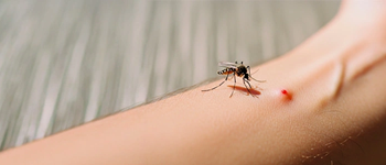 Picaduras de insectos en verano: ¿cuándo consultar con un dermatólogo?