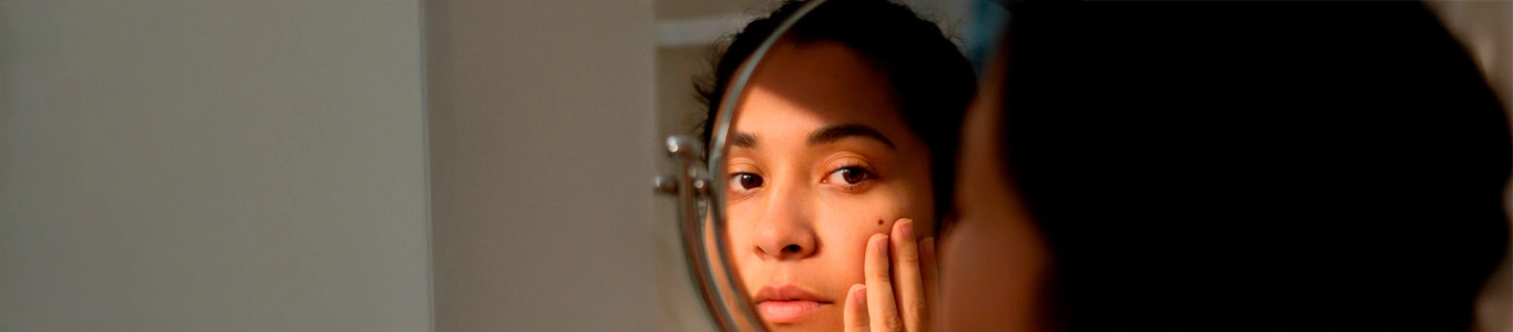 ¿Tienes un lunar? Conoce las señales de alerta y cuándo acudir al dermatólogo